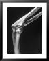 Skeletal Structures Of An Elbow, Showing Joint by Andreas Feininger Limited Edition Print