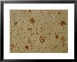 Alzheimers Disease, Bielchowsky Stain X64 by G. W. Willis Limited Edition Print